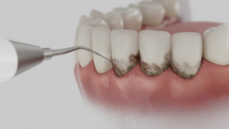 Trusted Invisalign Clear Aligners service in Wilmette, IL - Dentist Open Now